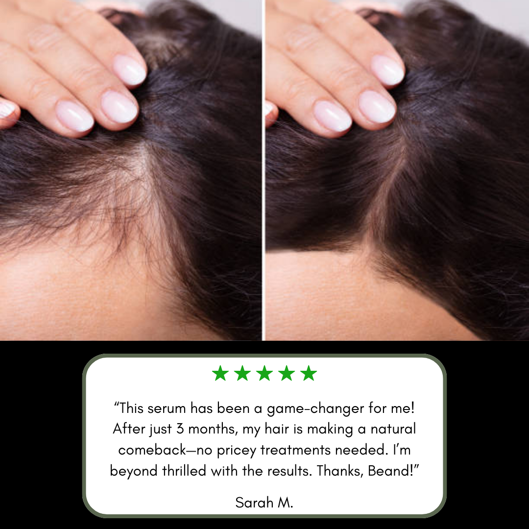 Beand™ Luneth Botanical Hair Growth