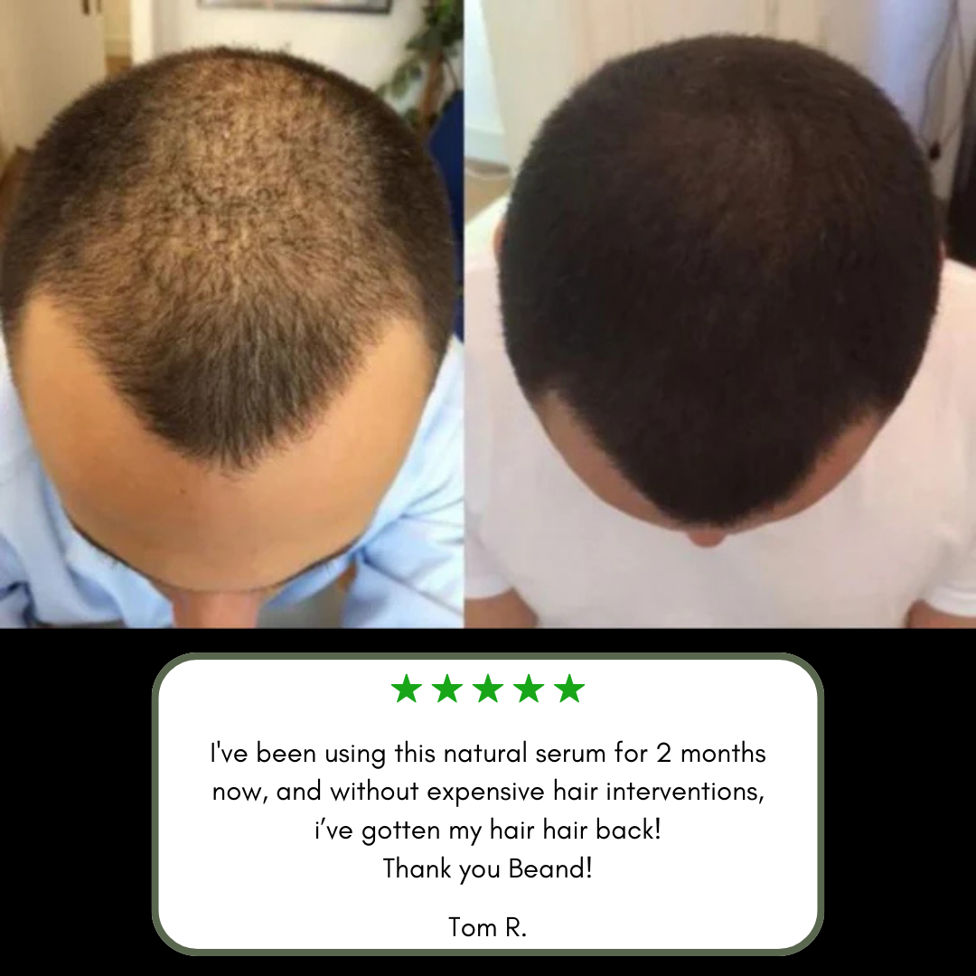 Beand™ Luneth Botanical Hair Growth